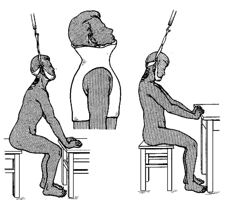 Упражнения для вытяжения шейного отдела позвоночного столба с помощью петли глиссона