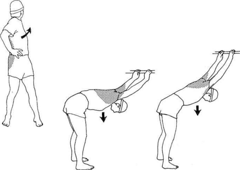 Гимнастика при плечелопаточном периартрите, упражнения лфк